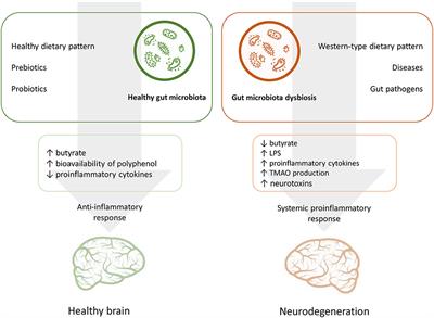 Nutrition, Gut Microbiota, and Alzheimer's Disease
